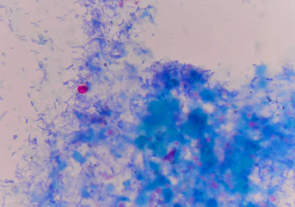 Oócito de cryptosporidium sobre azul — Fotografia de Stock