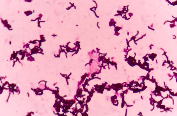 Бактеріальні клітини з методом грам-плями . — стокове фото