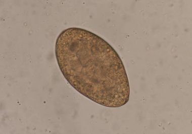 Egg of parasite in stool exam. clipart