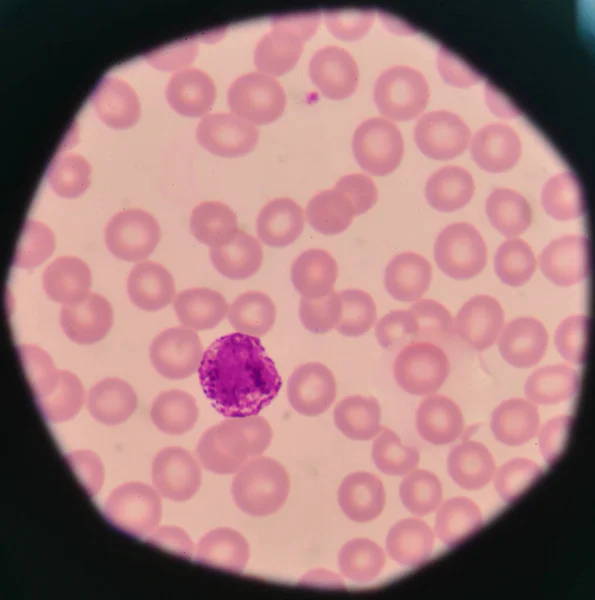 Glóbulos brancos no fundo dos glóbulos vermelhos . — Fotografia de Stock