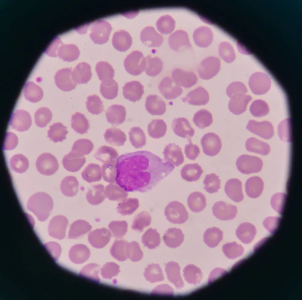 Weiße Blutkörperchen auf rotem Hintergrund. — Stockfoto