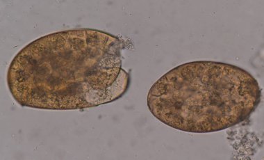 Mikroskop ile parazit yumurtaları.