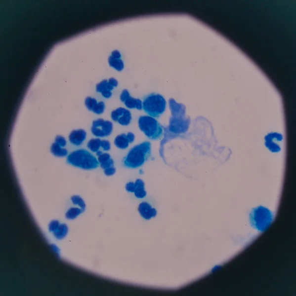 Кров'яні клітини з мікроскопом . — стокове фото
