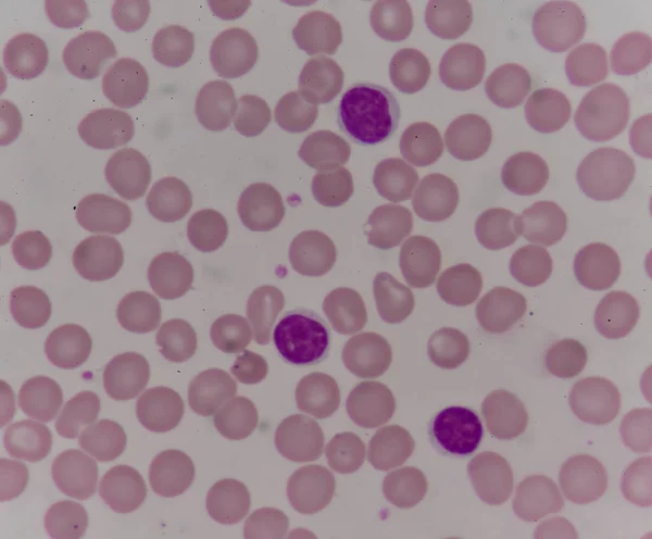 Cellule del sangue con microscopio . — Foto Stock