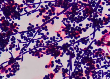 Maya hücre yapısı filizlenen