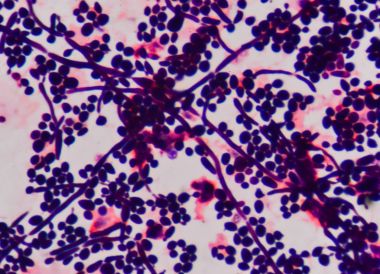 Maya hücre yapısı filizlenen