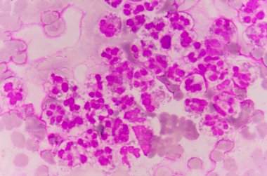 Kan yayması nötrofil hücre