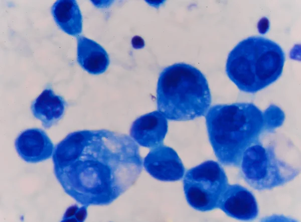 Blue cell with blue stain. — Stock Photo, Image
