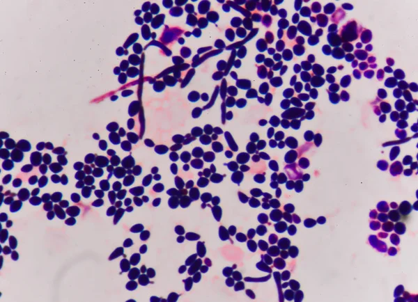 Estrutura de células de levedura brotamento — Fotografia de Stock