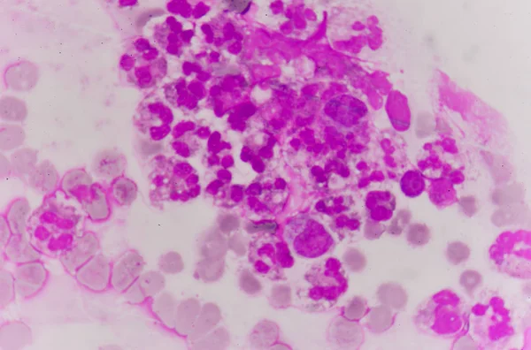 Cellula di neutrofilo nello striscio di sangue — Foto Stock