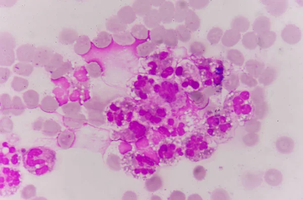 Célula de neutrófilo en frotis de sangre — Foto de Stock