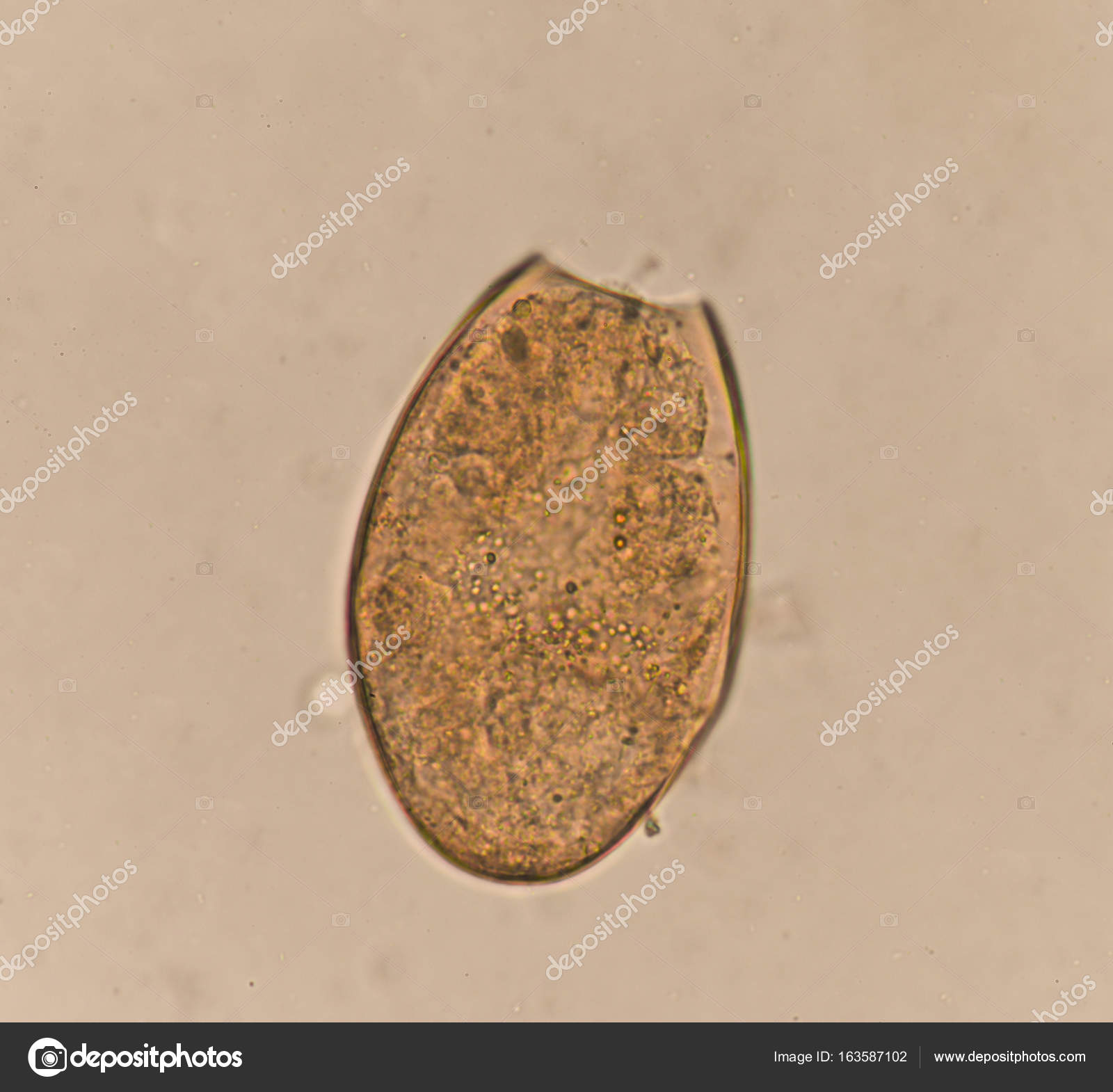 Egg parasite in stool human — Stock Photo © toeytoey #163587102