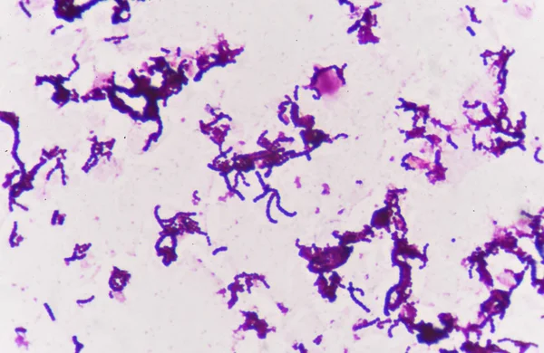 Gram staining, also called Gram's method,. — Stock Photo, Image