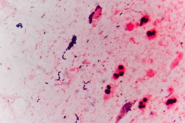 Bakteri hücreleri Gram pozitif cocci zincirindeki .