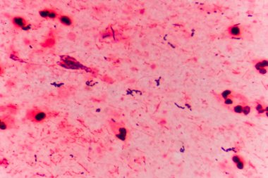 Bakteri hücreleri Gram pozitif cocci zincirindeki .