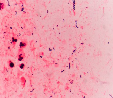 Bakteri hücreleri Gram pozitif cocci zincirindeki .