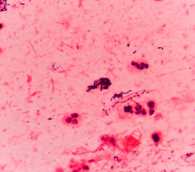 Bakteri hücreleri Gram pozitif cocci zincirindeki .