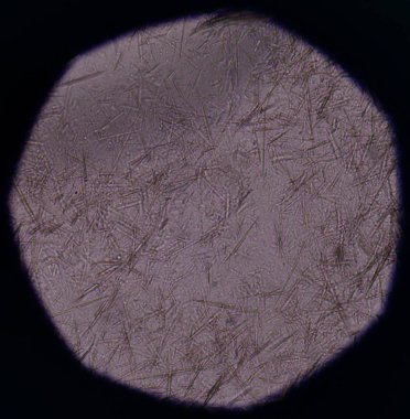 Orta Ürik asit kristal iğne şekli