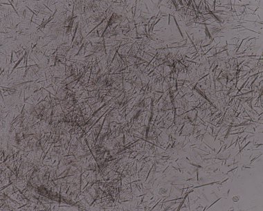 Orta Ürik asit kristal iğne şekli