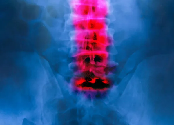 Pellicola a raggi X pelvi sfondo scienza medica — Foto Stock