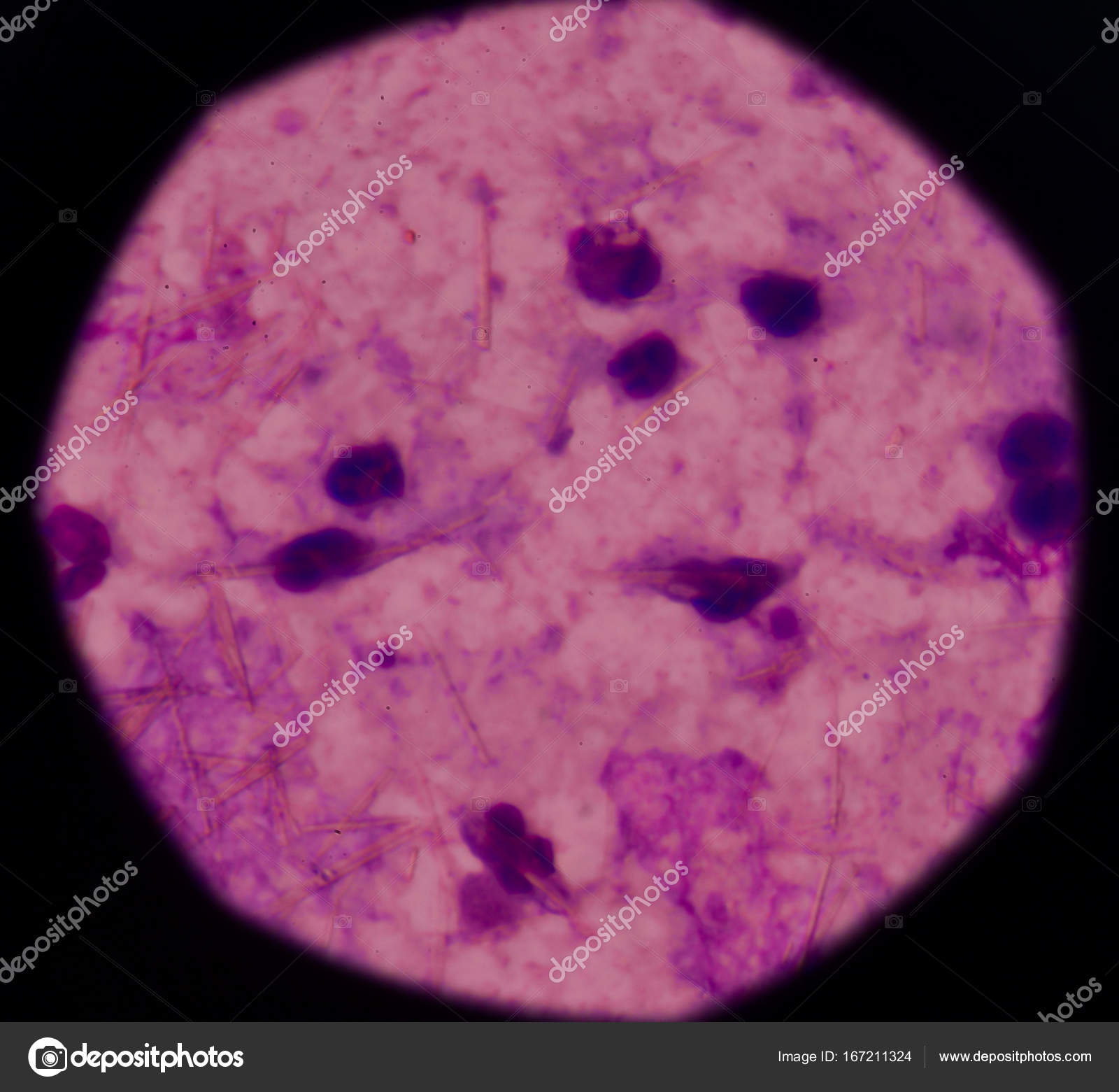 Pathology Outlines - Urine crystals \u0026 microscopy, image size:1600x1561