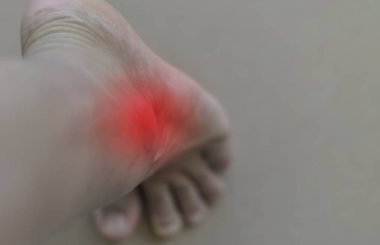 Ağrılı ve iltihaplı gut