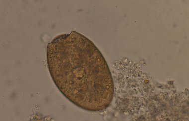 Big size Fasciola parasite egg. clipart