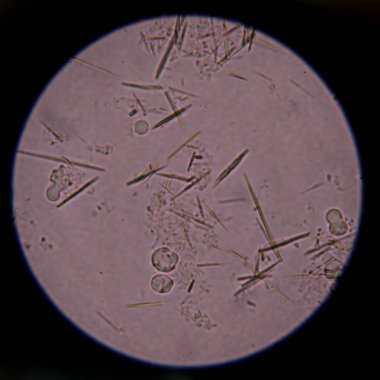 Orta Ürik asit kristal iğne şekli