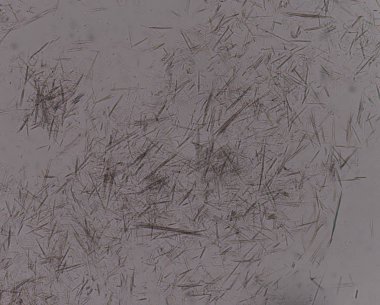 Orta Ürik asit kristal iğne şekli