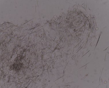 Orta Ürik asit kristal iğne şekli