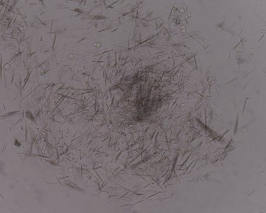 Orta Ürik asit kristal iğne şekli