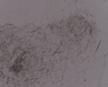 Orta Ürik asit kristal iğne şekli