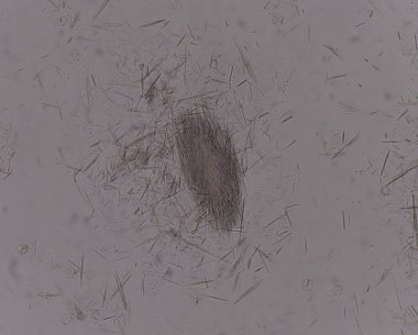 Orta Ürik asit kristal iğne şekli