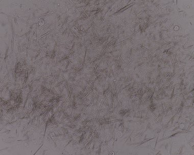 Orta Ürik asit kristal iğne şekli