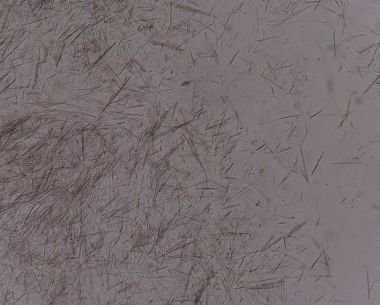 Orta Ürik asit kristal iğne şekli