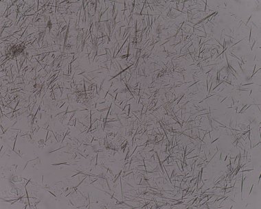 Orta Ürik asit kristal iğne şekli