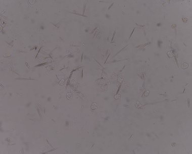 Orta Ürik asit kristal iğne şekli