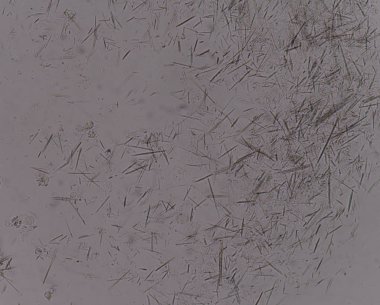 Orta Ürik asit kristal iğne şekli