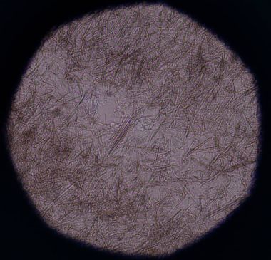 Orta Ürik asit kristal iğne şekli