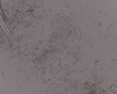 Orta Ürik asit kristal iğne şekli