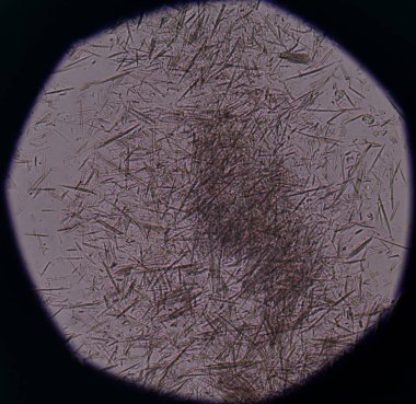 Orta Ürik asit kristal iğne şekli