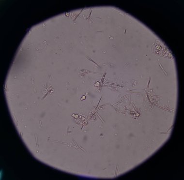 Orta Ürik asit kristal iğne şekli