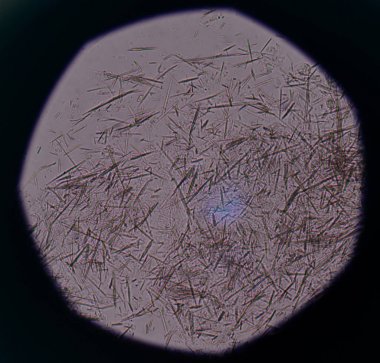 Orta Ürik asit kristal iğne şekli