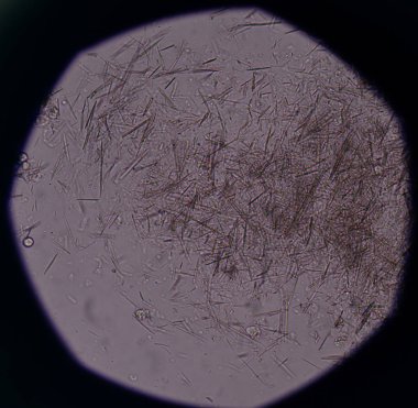 Orta Ürik asit kristal iğne şekli