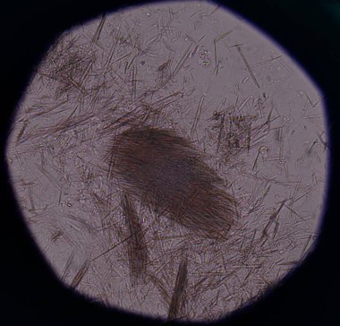 Orta Ürik asit kristal iğne şekli