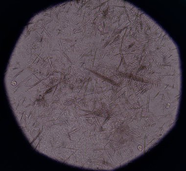 Orta Ürik asit kristal iğne şekli