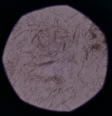 Orta Ürik asit kristal iğne şekli