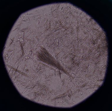 Orta Ürik asit kristal iğne şekli