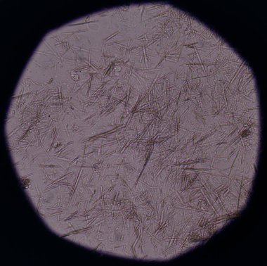 Orta Ürik asit kristal iğne şekli