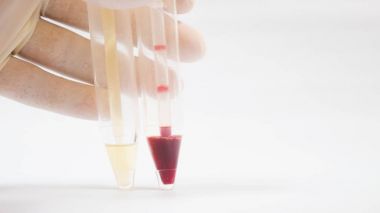 Beyaz üzerine idrar analizi.